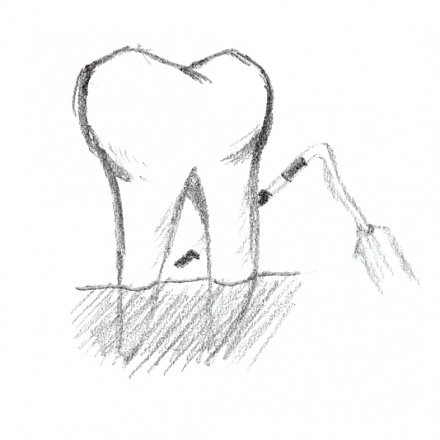 Periodoncia